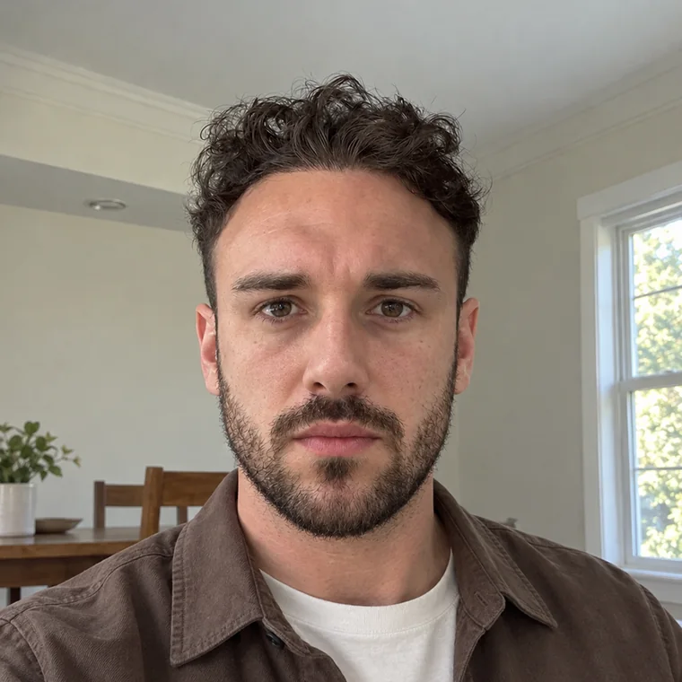 Frontal Hairline, after, everyday, Hair Transplant Design Tampa