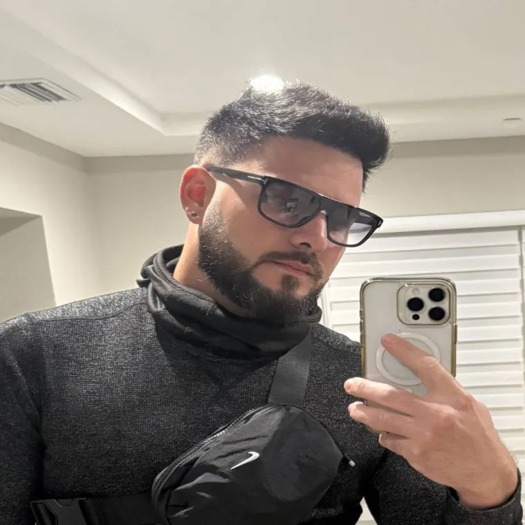 Restauración capilar súper completa, después, en el día a día, Hair Transplant Design Tampa