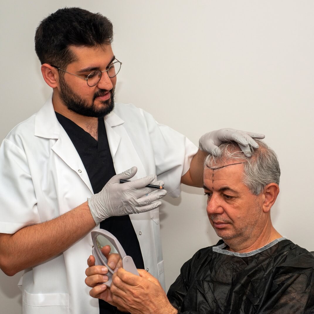 Hair Transplant 4 You in Tampa