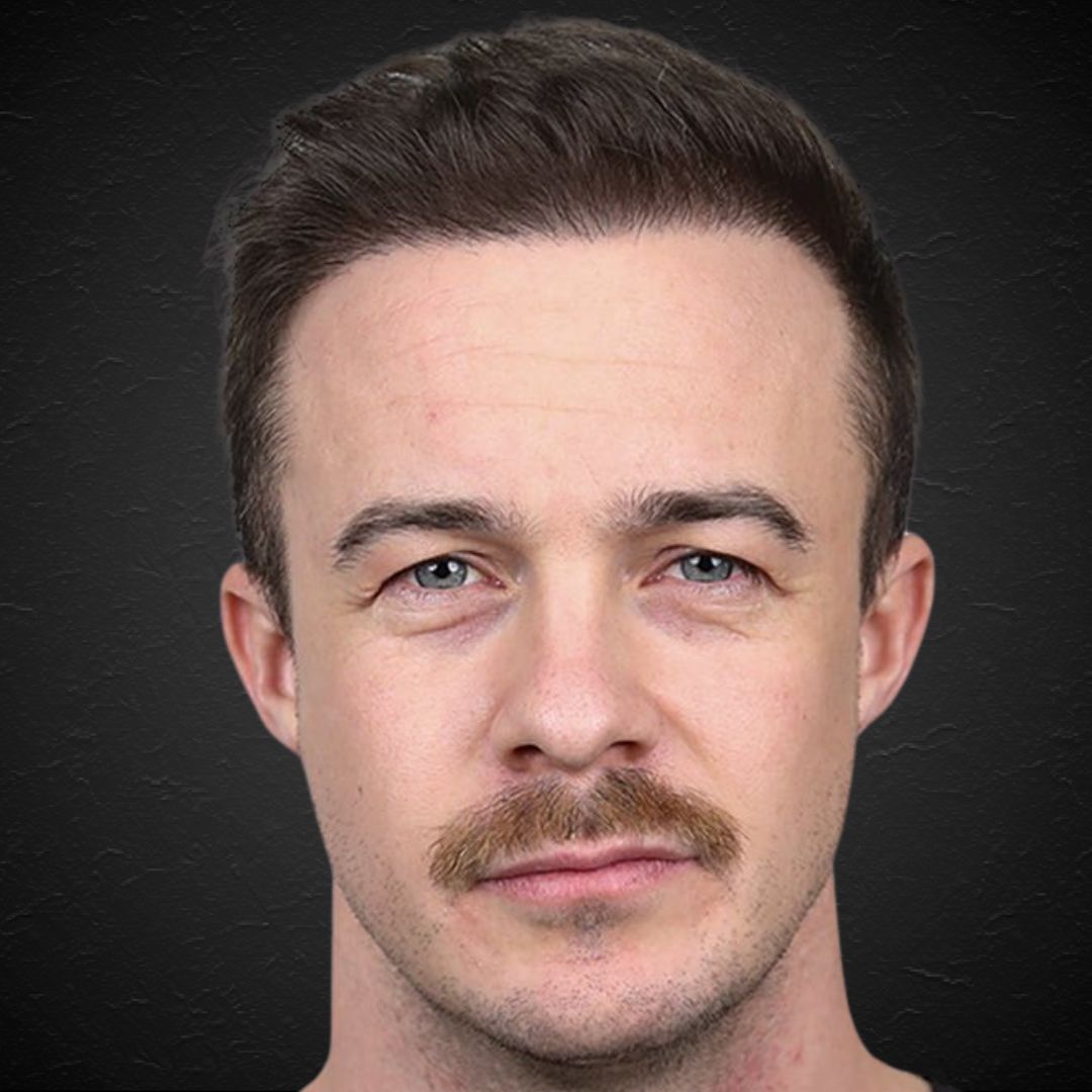 Hair Transplant Design (15)