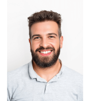 Jorge Hair Transplant Before and after
