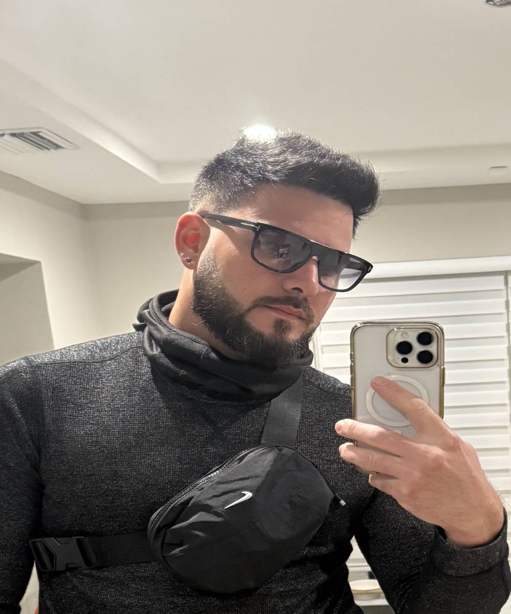 Raul Hair Transplant After 3