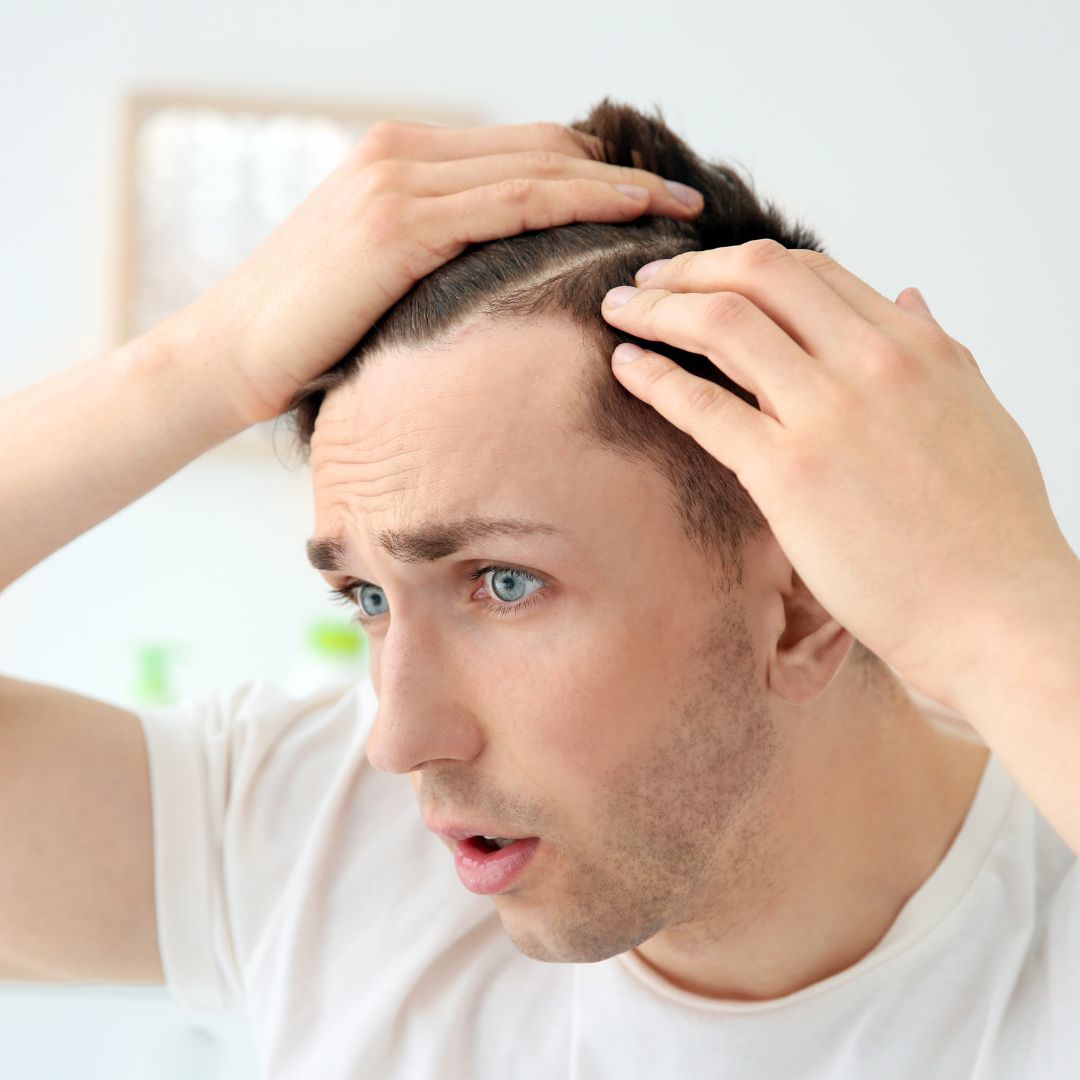 Why does hair shed after a transplant