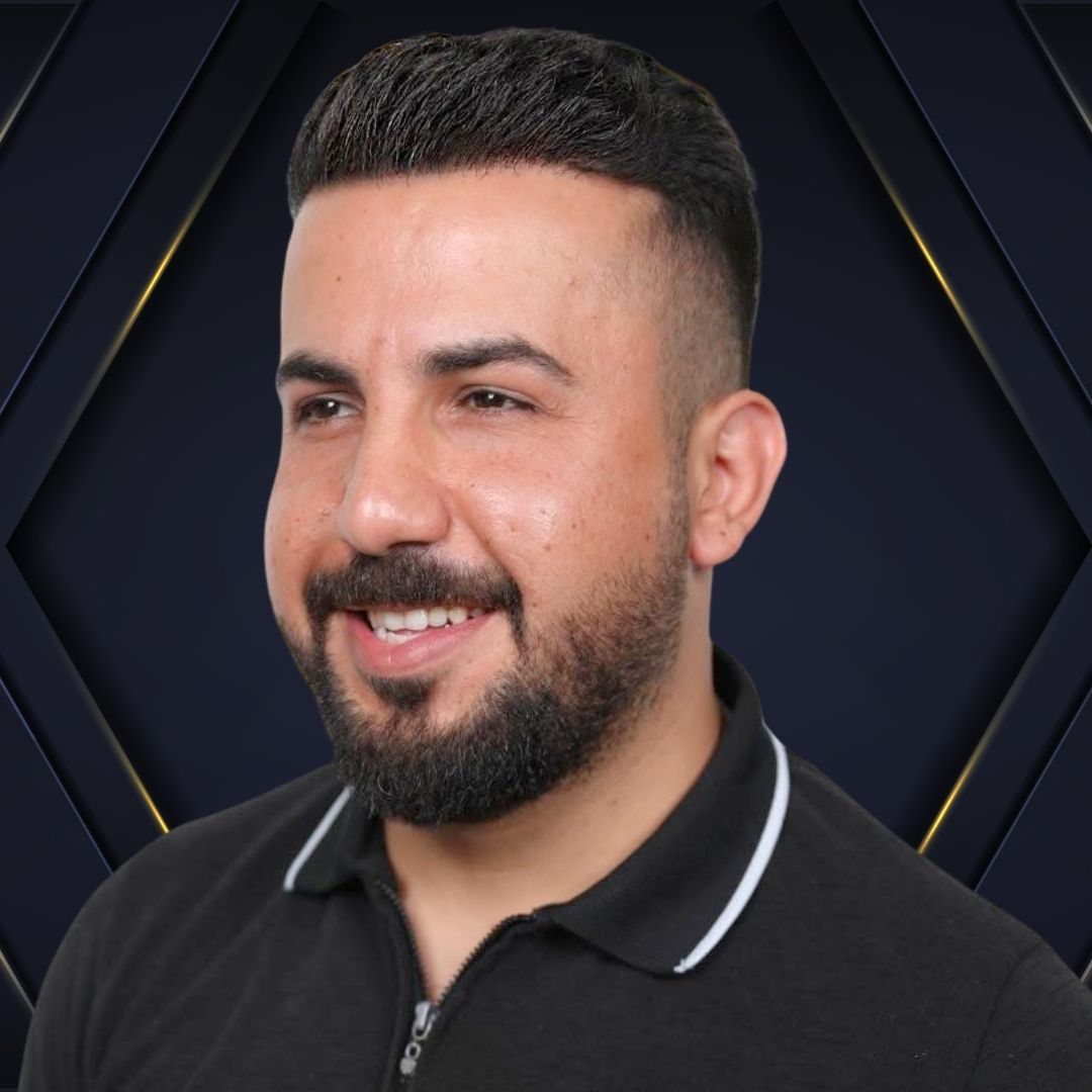 Fabio - Hair transplant Densign - Before and After 4