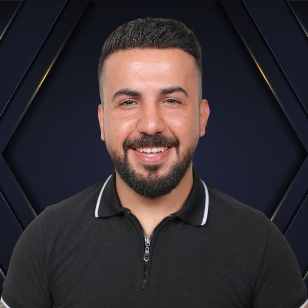 Fabio - Hair transplant Densign - Before and After 5