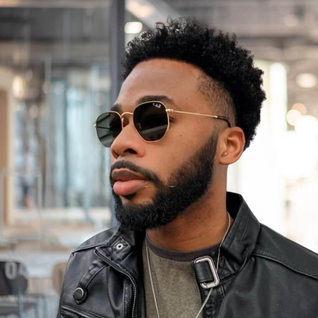 Hair Transplant Design in Tampa - Before and after